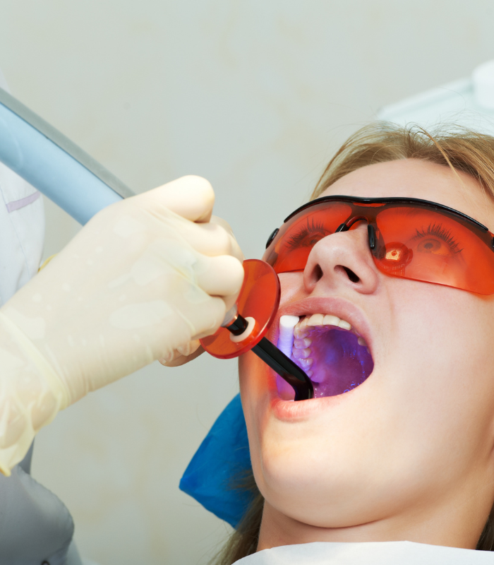 Dental Filling